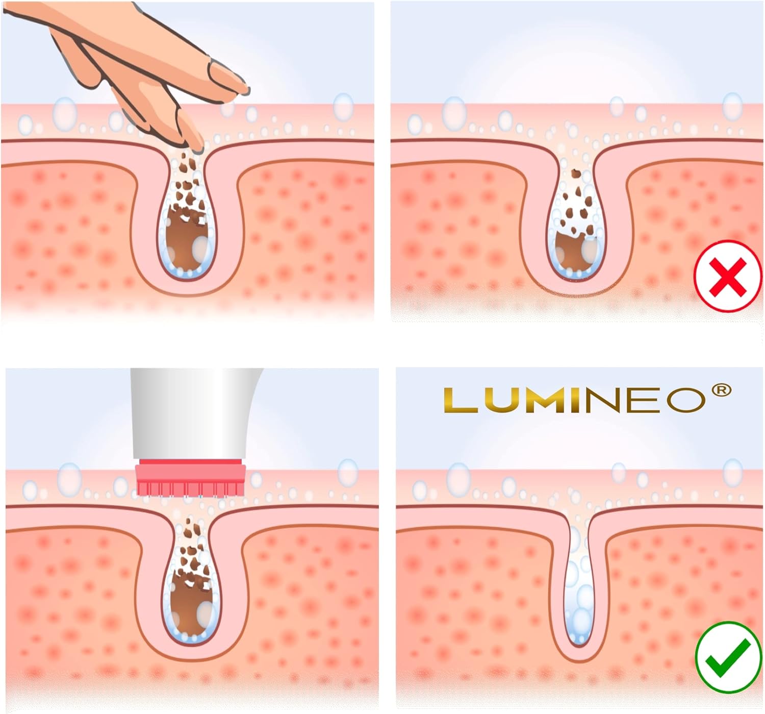 Lumineo Gel visage impur, conçu pour les brosses électriques pour le visage, particulièrement crémeux, anti-imperfections, anti-boutons anti-acné, nettoyant